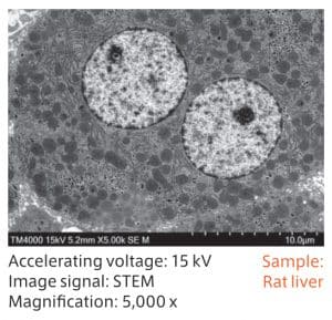 STEM example 2